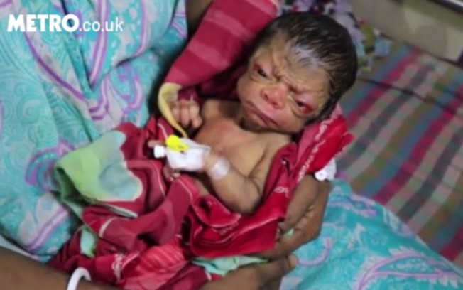  O médico que atende a criança contou à publicação que o menino 