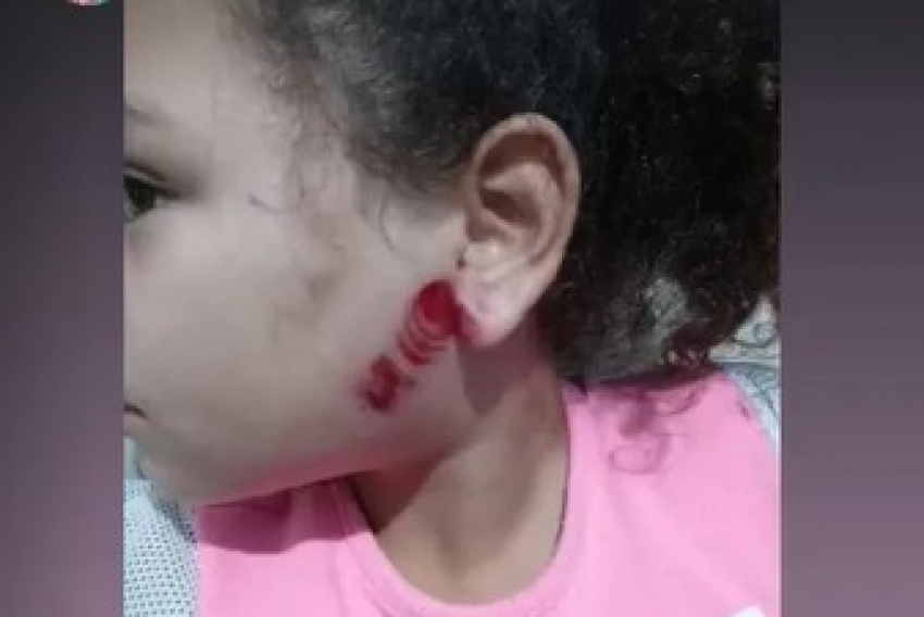 Garota ferida em tumulto no Campo dos Alemães