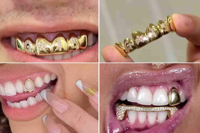 Vários modelos de “grillz” e outras formas de ouro nos dentes!