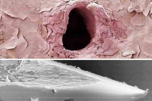 Orifício na pele pela entrada e saída de agulha, vista no microscópio eletrônico. Em baixo, agulha com bisel em anzol na ponta, depois da injeção de anestésico