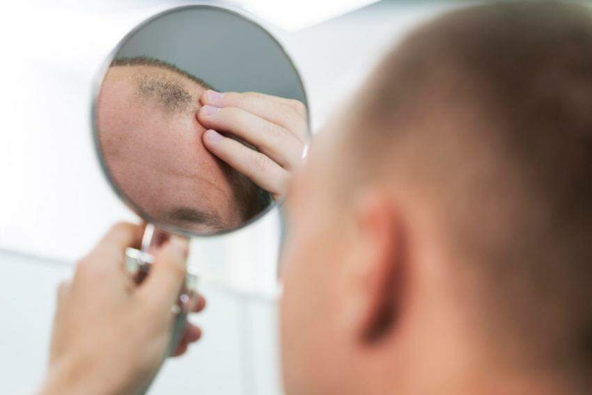 Perda de cabelo é mais comum nos homens