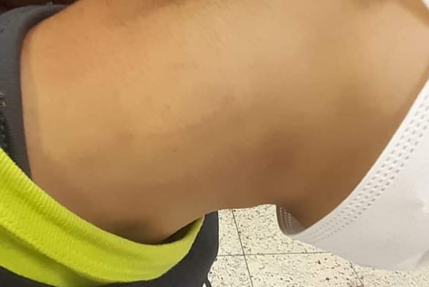Aluna afirma ter sido mordida no pescoço por estudante dentro da escola