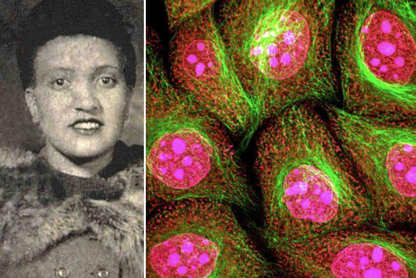 Henrietta Lacks e suas células imortais!
