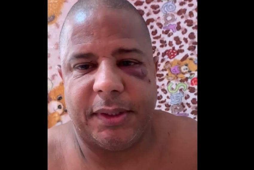Marcelinho aparece sem camisa e com o olho roxo no vídeo
