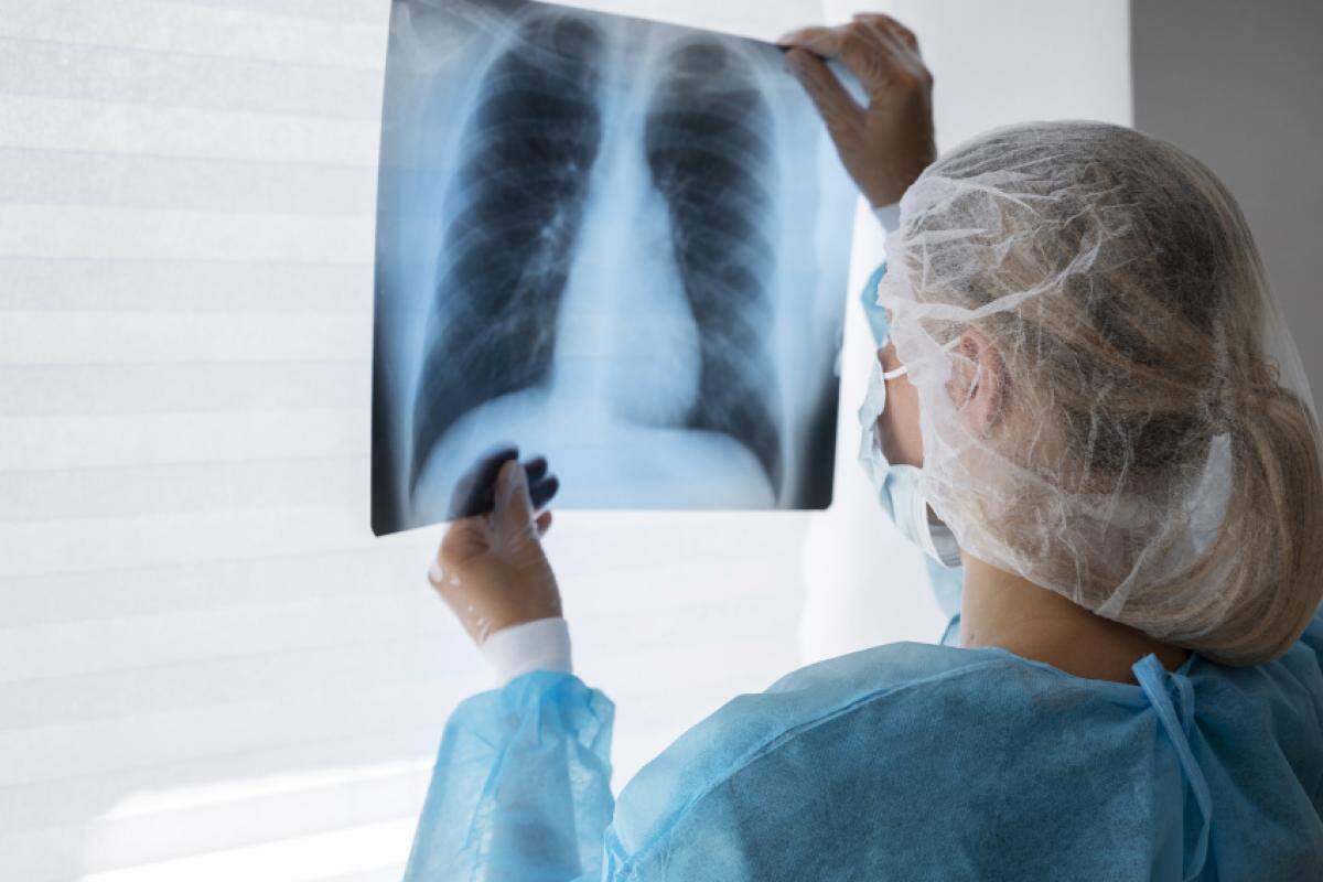 A tuberculose tem cura e o tratamento dura no mínimo seis meses. 