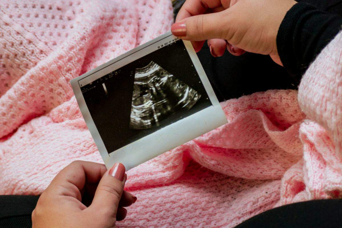 Não há limite de idade gestacional para a interrupção da gravidez nos casos previstos em lei.