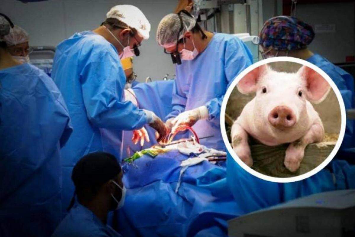 O porco foi mudado geneticamente para ser aceito pelo sistema imunológico do paciente