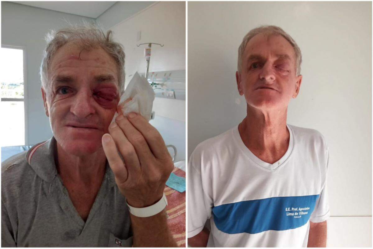 João Gilberto Palhares de 57 anos: diagnosticado com uma infecção ocular causada por larvas