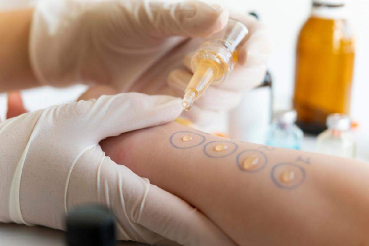 Exame para diagnóstico de alergia