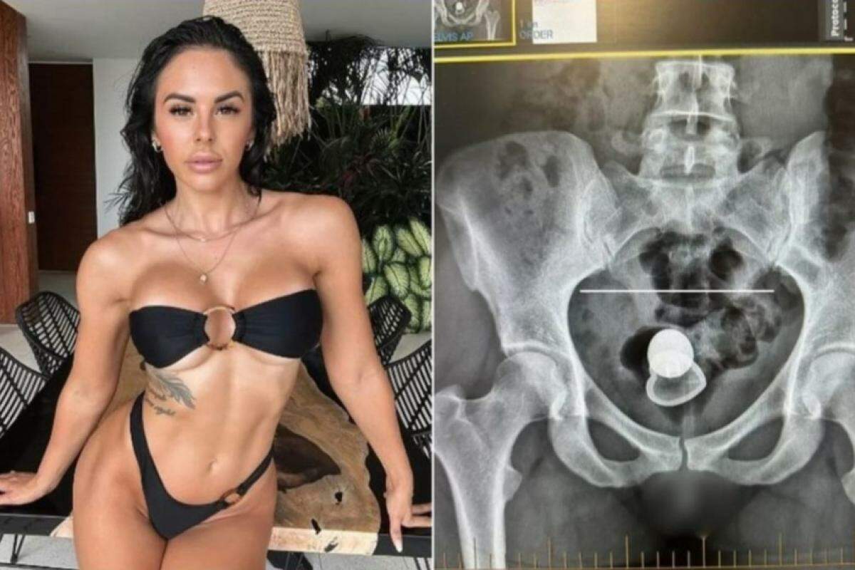Alicia Davis, de 32 anos, é famosa nas redes sociais da Austrália