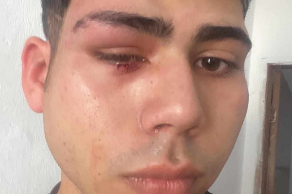 Vinny Correia denuncia agressão na região leste