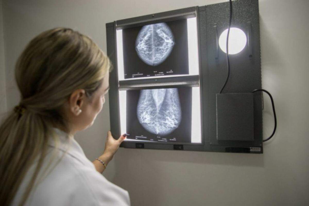 Carreta da Mamografia, do Programa Mulheres de Peito, do Governo do Estado, está em Pirajuí nesta terça (23), para diagnóstico do câncer de mama