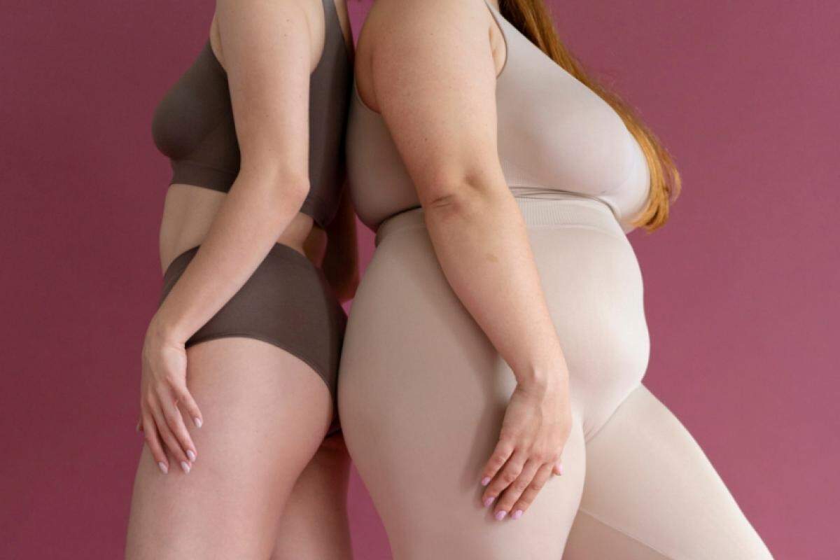 O lipedema ainda é pouco diagnosticado