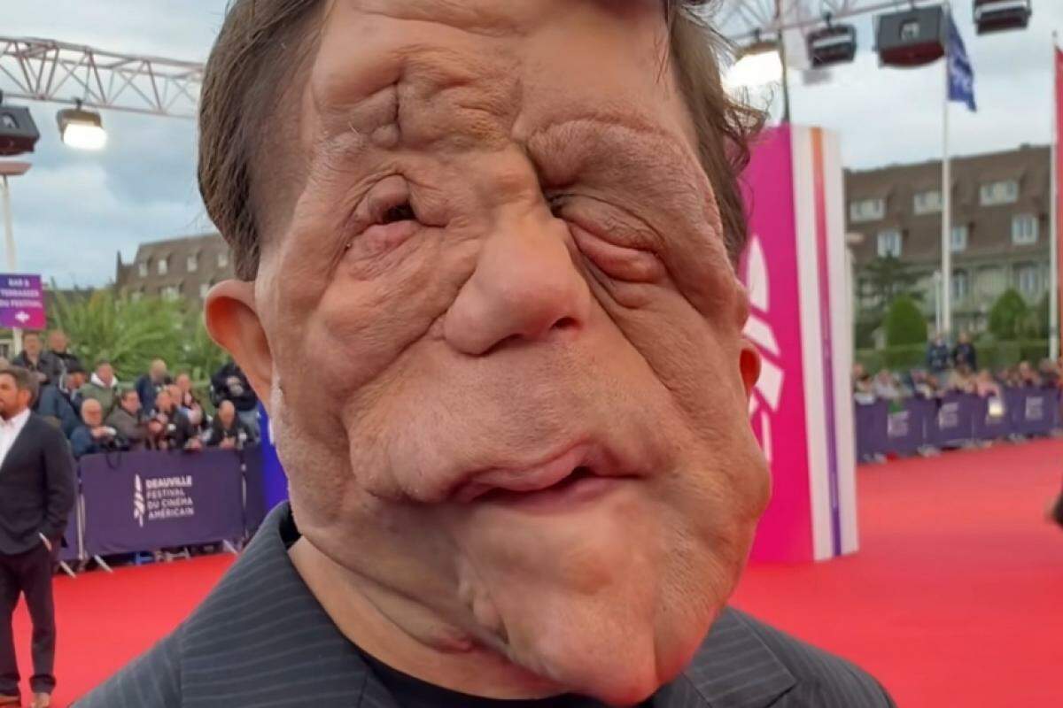 O ator britânico Adam Pearson sempre foi notado pela deformação no seu rosto