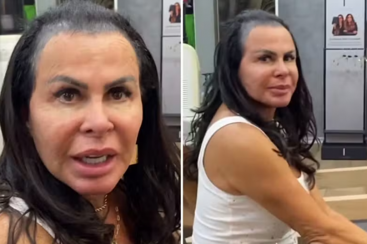 Gretchen publicou um vídeo em que aparece sem a prótese capilar