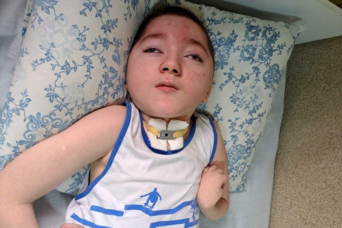 Miguelzinho, de 11 anos, enfrenta um tratamento contínuo contra a rara Síndrome de Fires