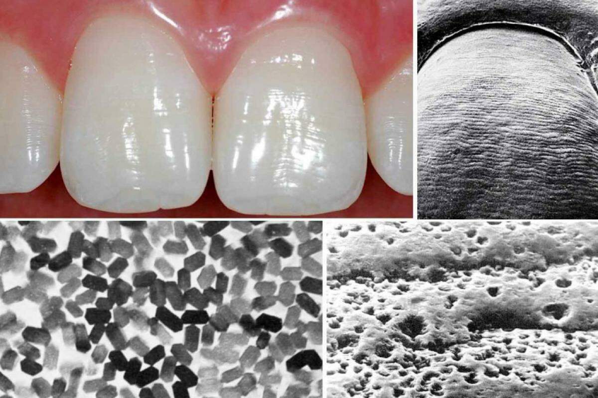 O esmalte, no microscópio eletrônico, tem superfície ondulada, porosa e os seus cristais