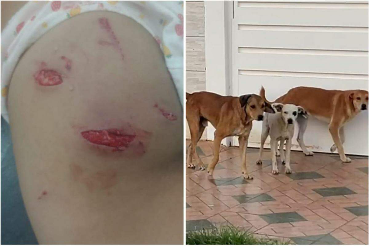 Pais relatam desespero ao salvar a criança dos cães que continuam soltos no Jardim Alvorada