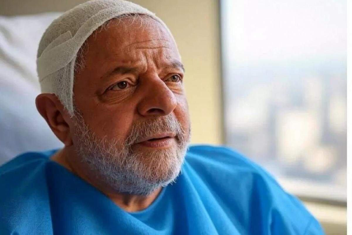 Lula não está com a cabeça enfaixada: montagem feita por IA