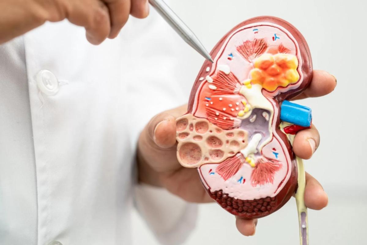 Calor e predisposição à desidratação tornam mais vulnerável a saúde dos rins e do trato urinário