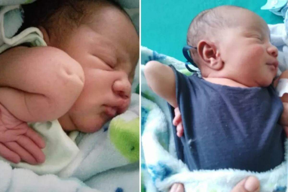 Mãe só descobriu a doença do menino no momento do parto