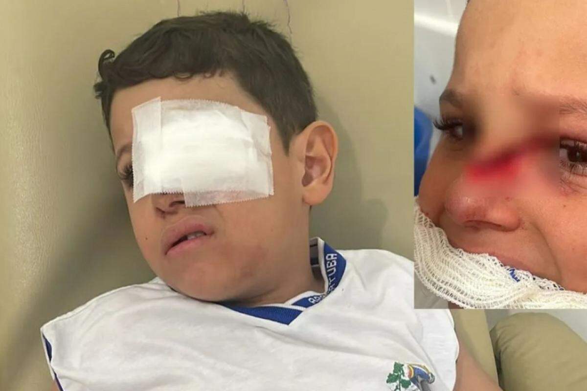 Menino foi socorrido pelo SAMU e passou por cirurgia; pai cobra apuração dos fatos e questiona falta de imagens de segurança