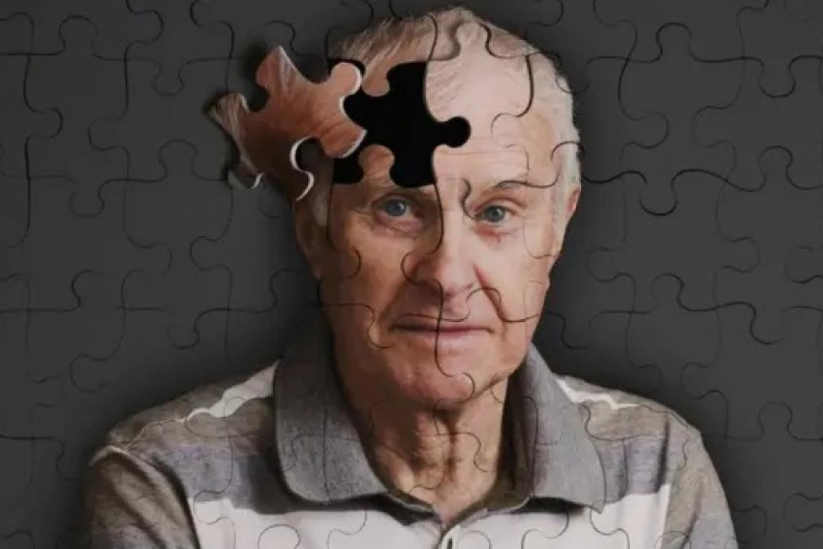 A condição, de origem neurodegenerativa, envolve diferentes alterações cognitivas, sendo a perda de memória apenas uma delas