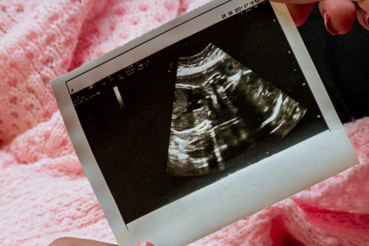 Adolescente de 13 anos que vive em Goiás teve o aborto legal negado pelo TJ-GO em 2023.