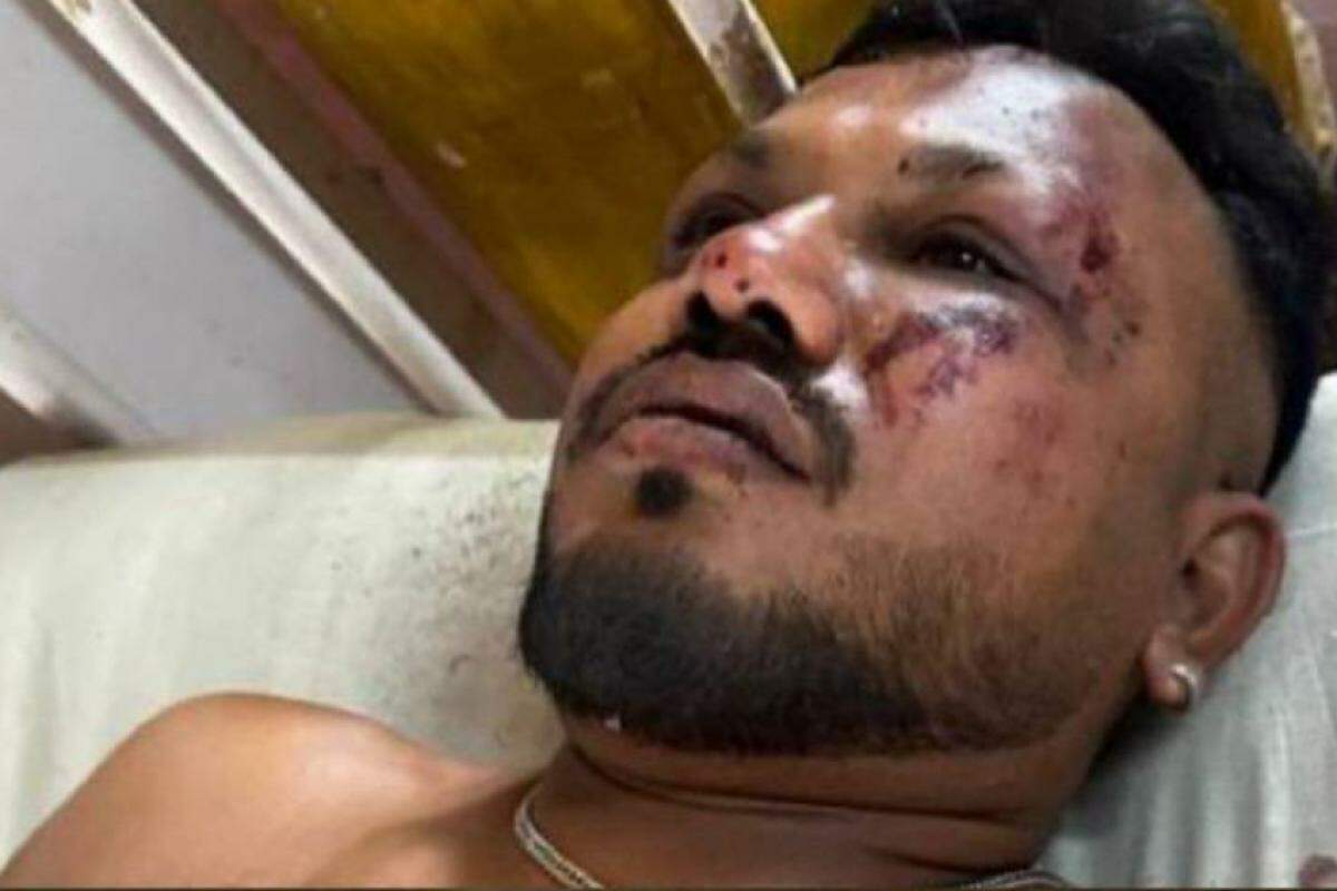 A vítima, identificada como o britânico Vishwas Kumar Ramesh, está sendo atendido em um hospital local.