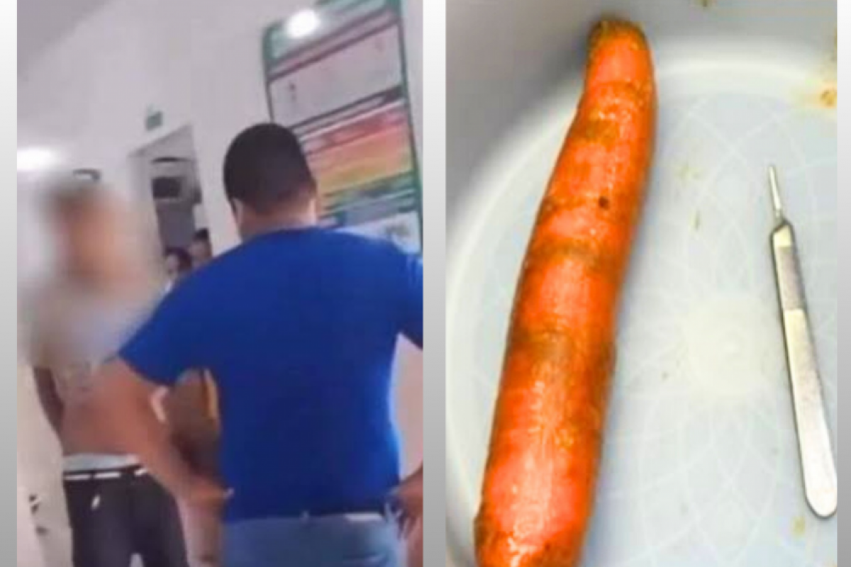 Após a constatação, o legume foi retirado pela equipe médica.