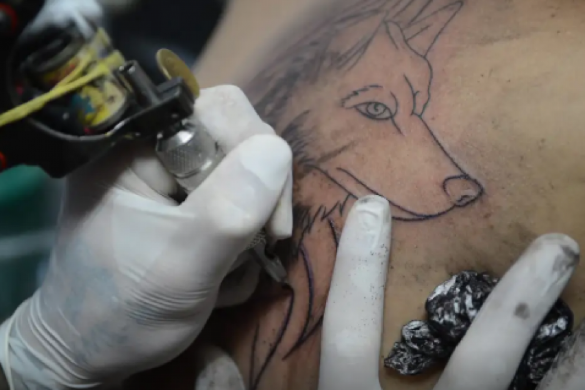 A decisão do CFM recebeu o apoio da Sociedade Brasileira de Anestesiologia (SBA)