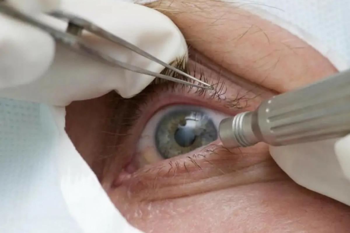 Entre os fatores de risco para problemas de visão a serem relatados durante as consultas estão a presença de doenças crônicas 