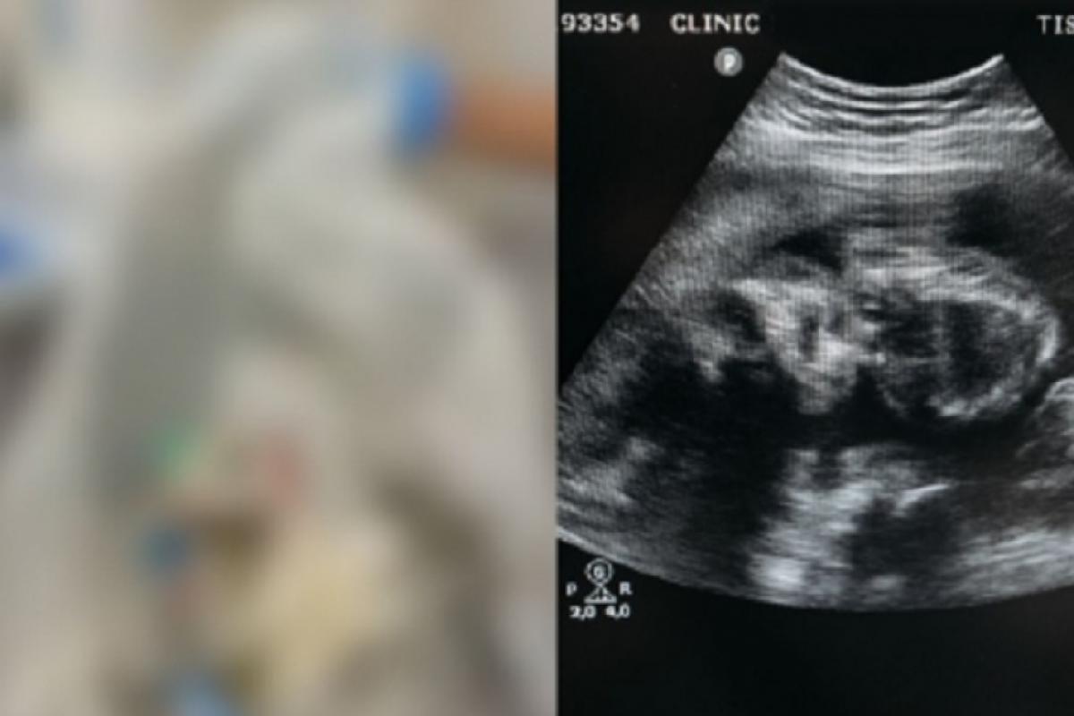 Fez @b0rt0 clandestino no motel com ajuda de amante e morreu