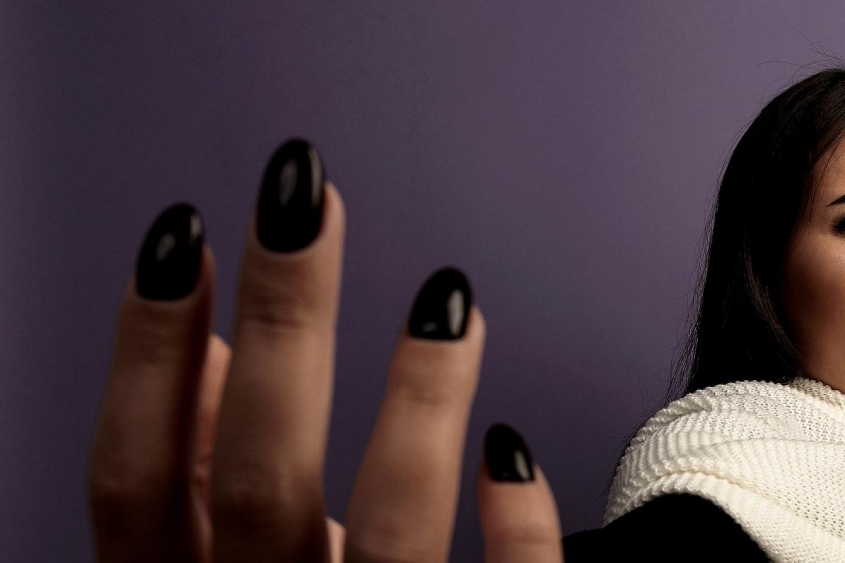 O homem relatou à polícia que a mulher o empurrou e arranhou seu rosto. 