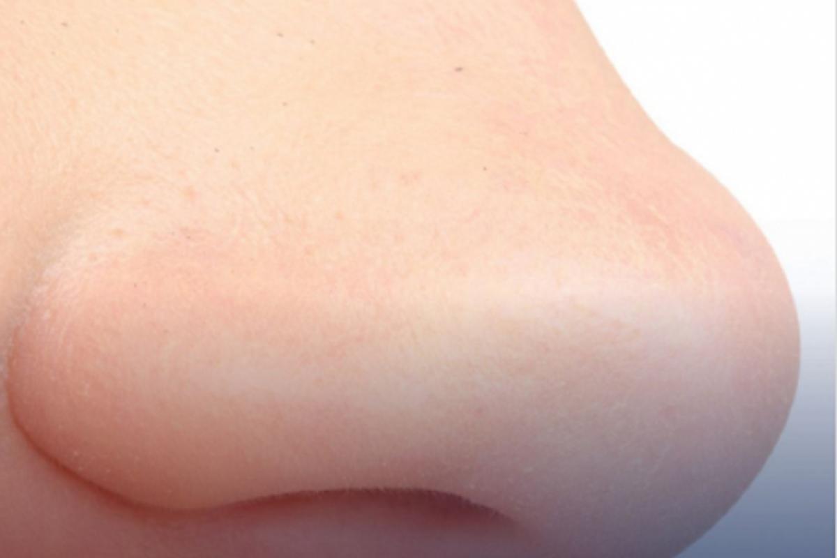 Arrancou o nariz da esposa com uma mordida e acabou preso