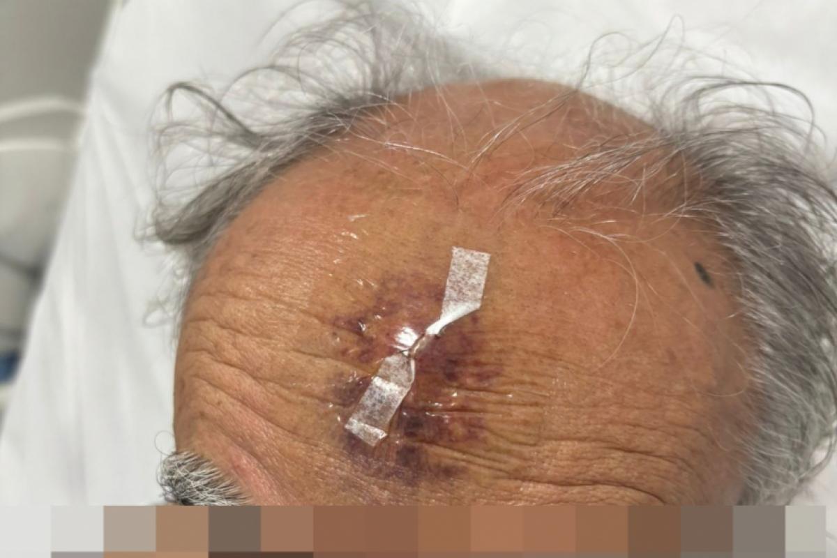 Ferimento teve equimose e está sendo tratado