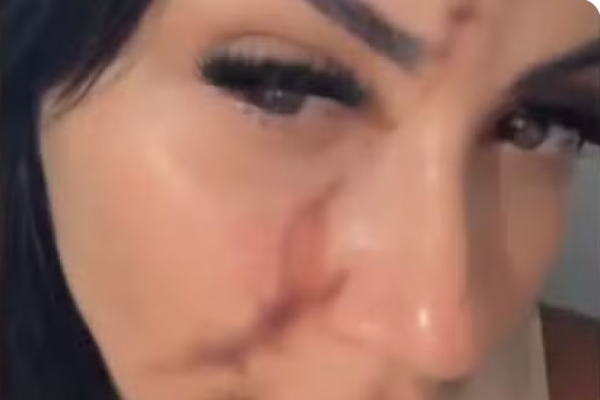 Carla foi atacada após tentar intervir em um conflito entre seus filhos gêmeos, de 12 anos, e um colega de 11 anos.