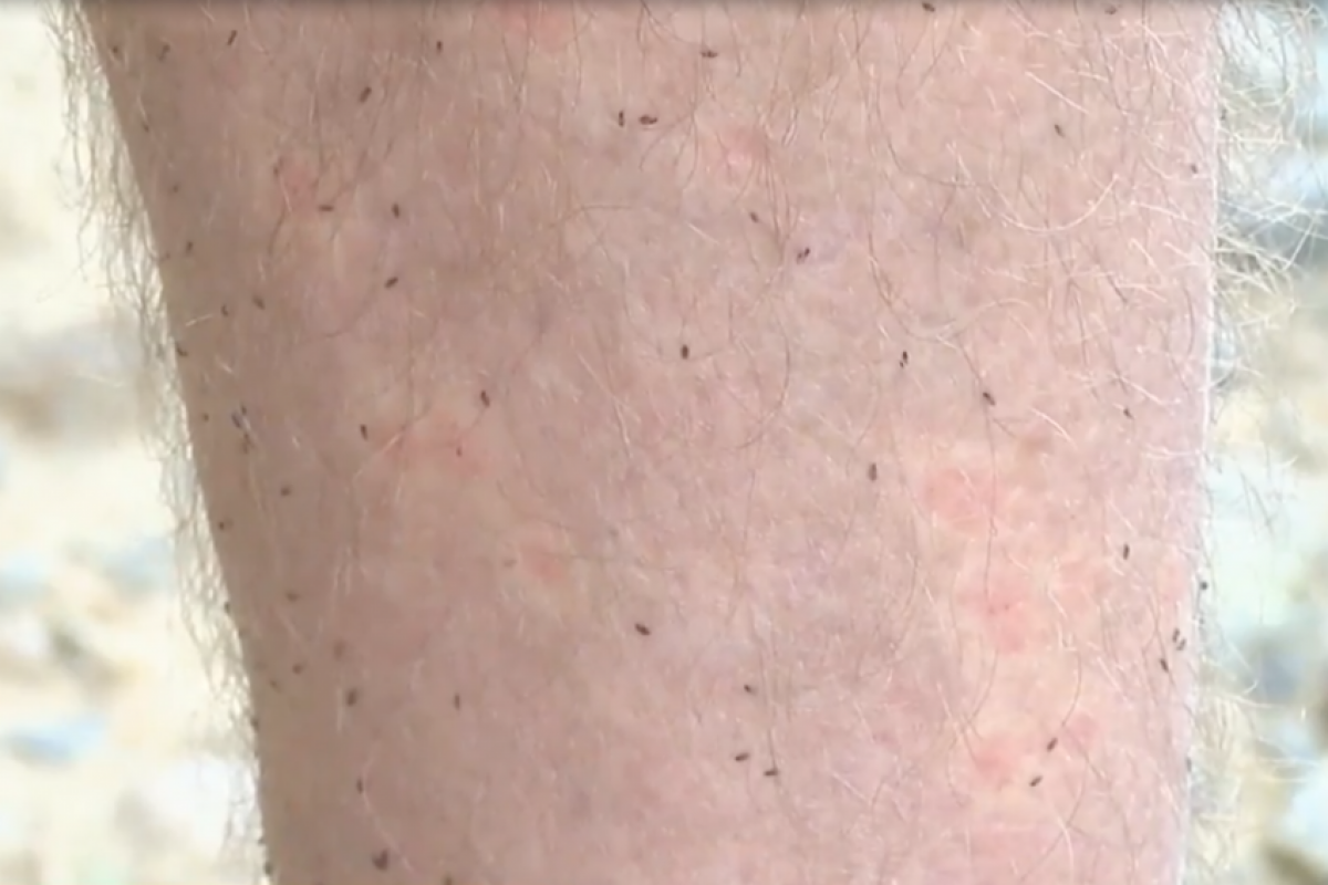 A presença do mosquito não é novidade na região, mas os moradores relatam que a situação piorou nos últimos anos.