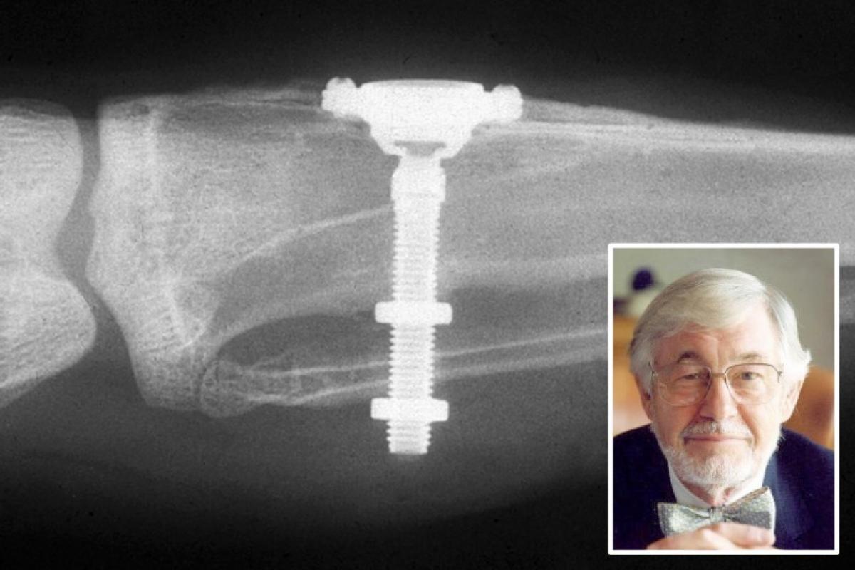 Uma das câmeras fotográficas em que Branemark observou o osso integrando-se na superfície do metal.