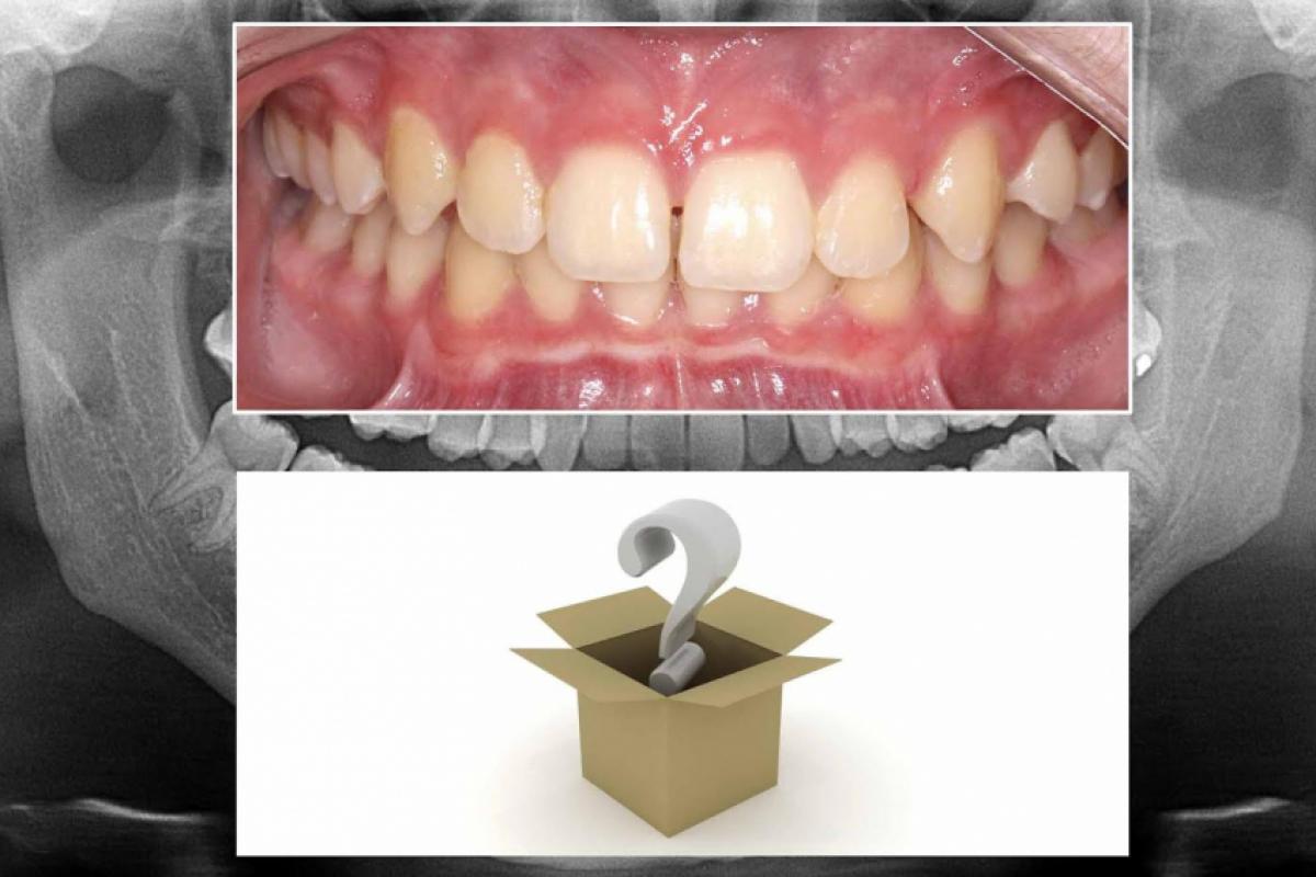 Como saber o que se tem nas raízes dentárias e ossos maxilares se não obtivermos imagens previamente para visualizá-los?
