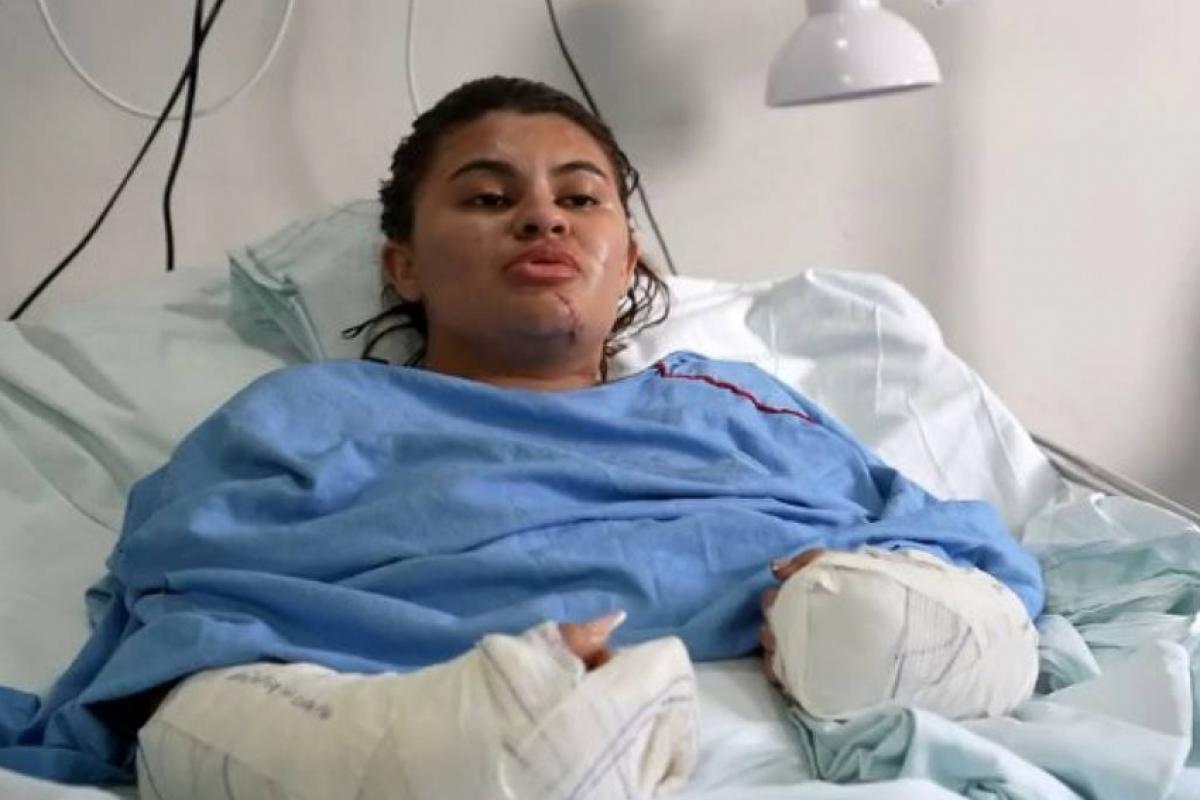 Ana Clara Oliveira, 21, escapou da morte