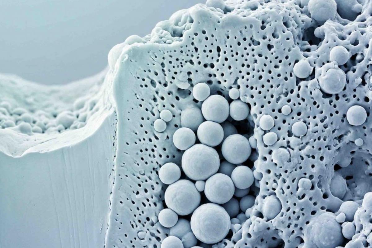 Calcosferitos são núcleos esféricos de mineralização que um se une ao outro e forma um tecido homogêneo como na dentina cheia de túbulos