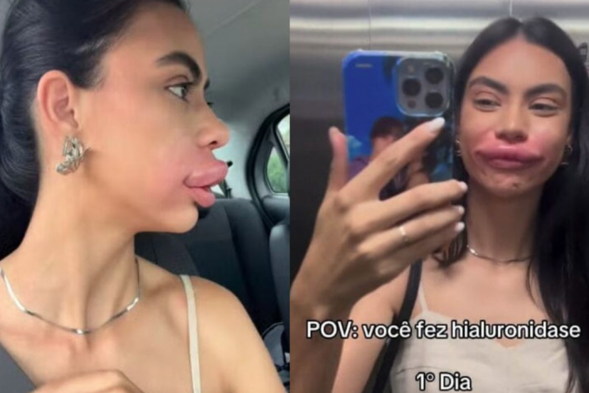 Conhecida como Miss Universe Pomerode, Iara publicou o vídeo em tom de brincadeira.