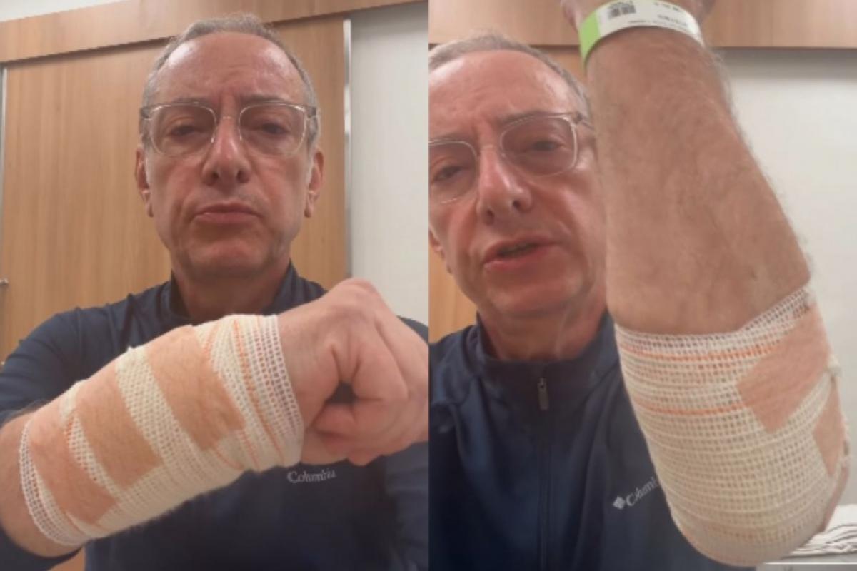 José Roberto Burnier exibe os ferimentos após ataque por pitbull