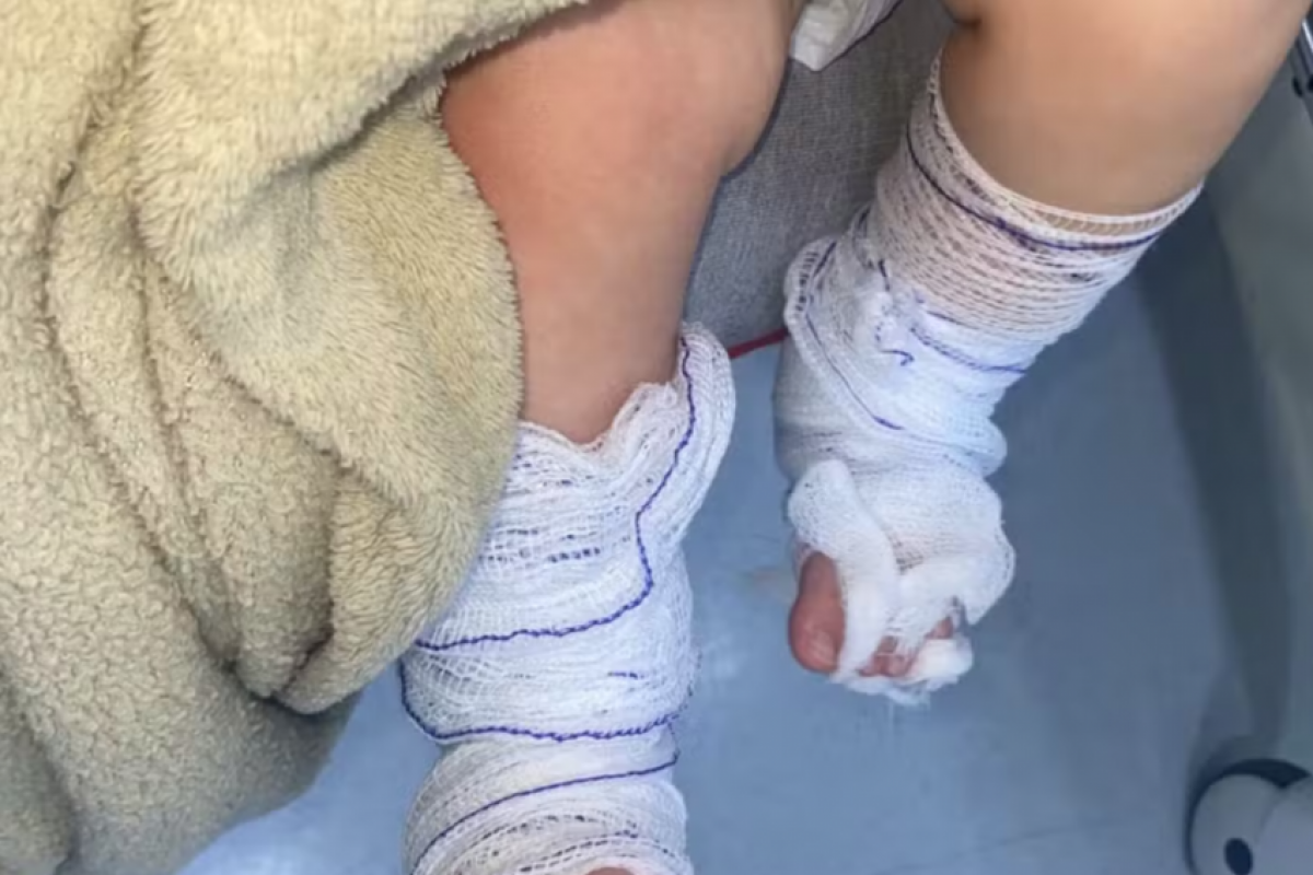 A criança permanece internada.