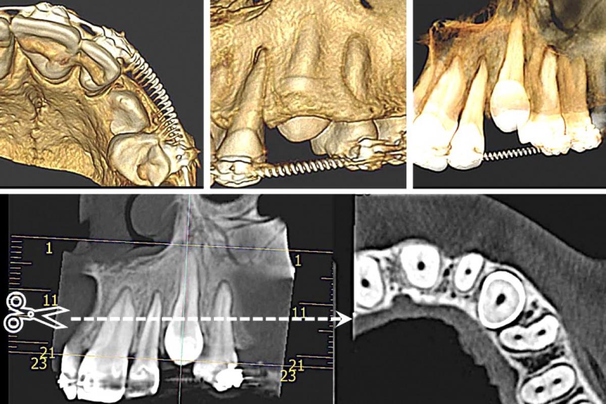 Tomografias reconstroem em 3D e oferecem planos como cortes de observação em todos os sentidos para avaliarmos ossos e dentes