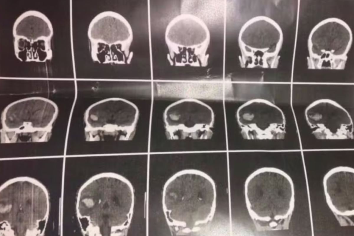 Segundo a escola, os estudantes afirmaram que a agressão aconteceu durante uma brincadeira no horário de saída. 